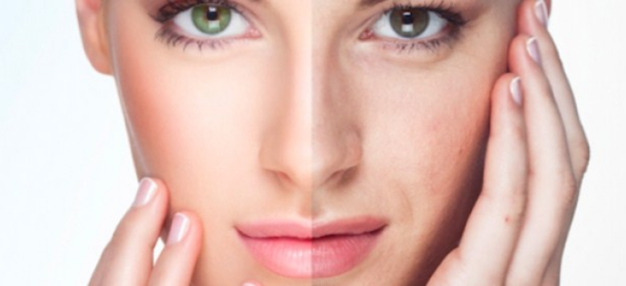 PRX-T33 Peel For Biorevitalisation + WiQO Fliude-5 vials*4ml+ 30ml (Italy) - Image 2